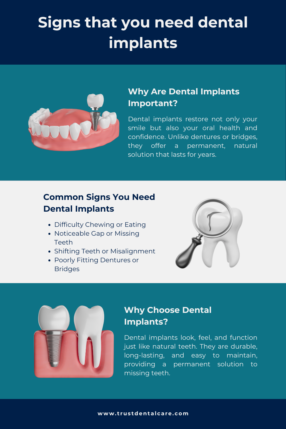 8 signs that you need dental implants