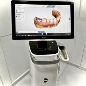 AI 3D Implant Planning Software and Surgical Guides