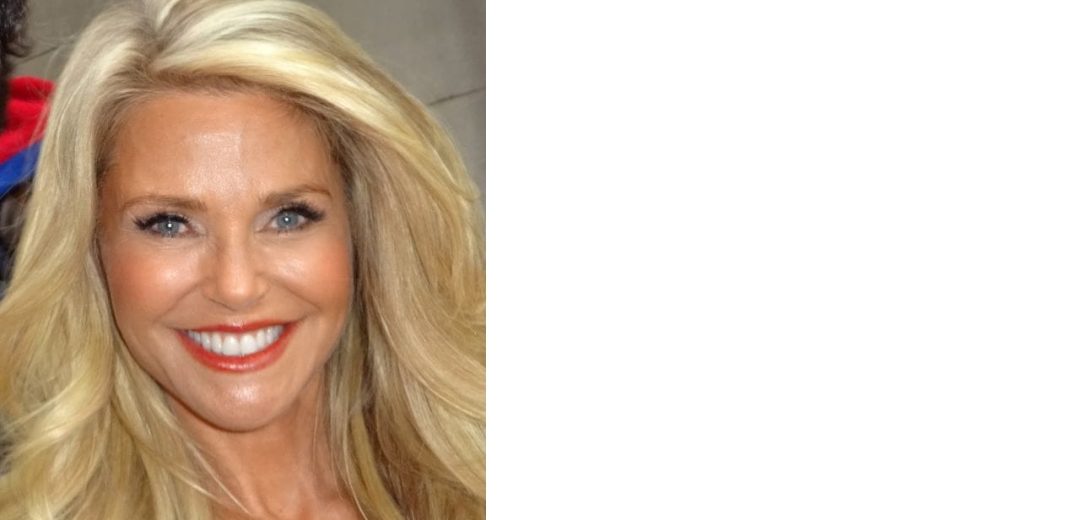 Christie Brinkley before dental implants