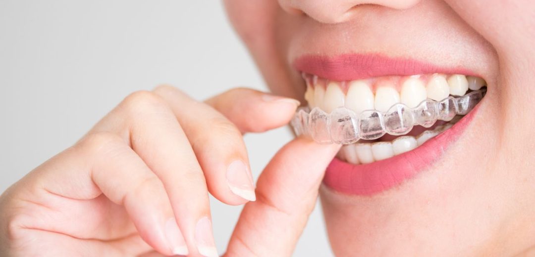 How to Clean mouthguard