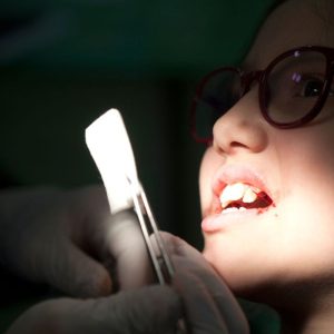 Image of Dental Extraction