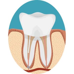 Demo Root canal procedure in tijuana