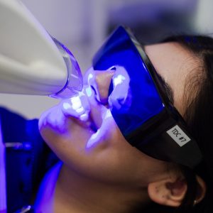 Zoom Teeth Whitening in Tijuana
