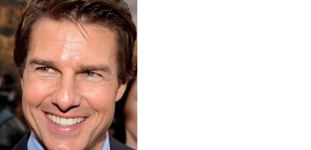 Tom Cruise before dental implants