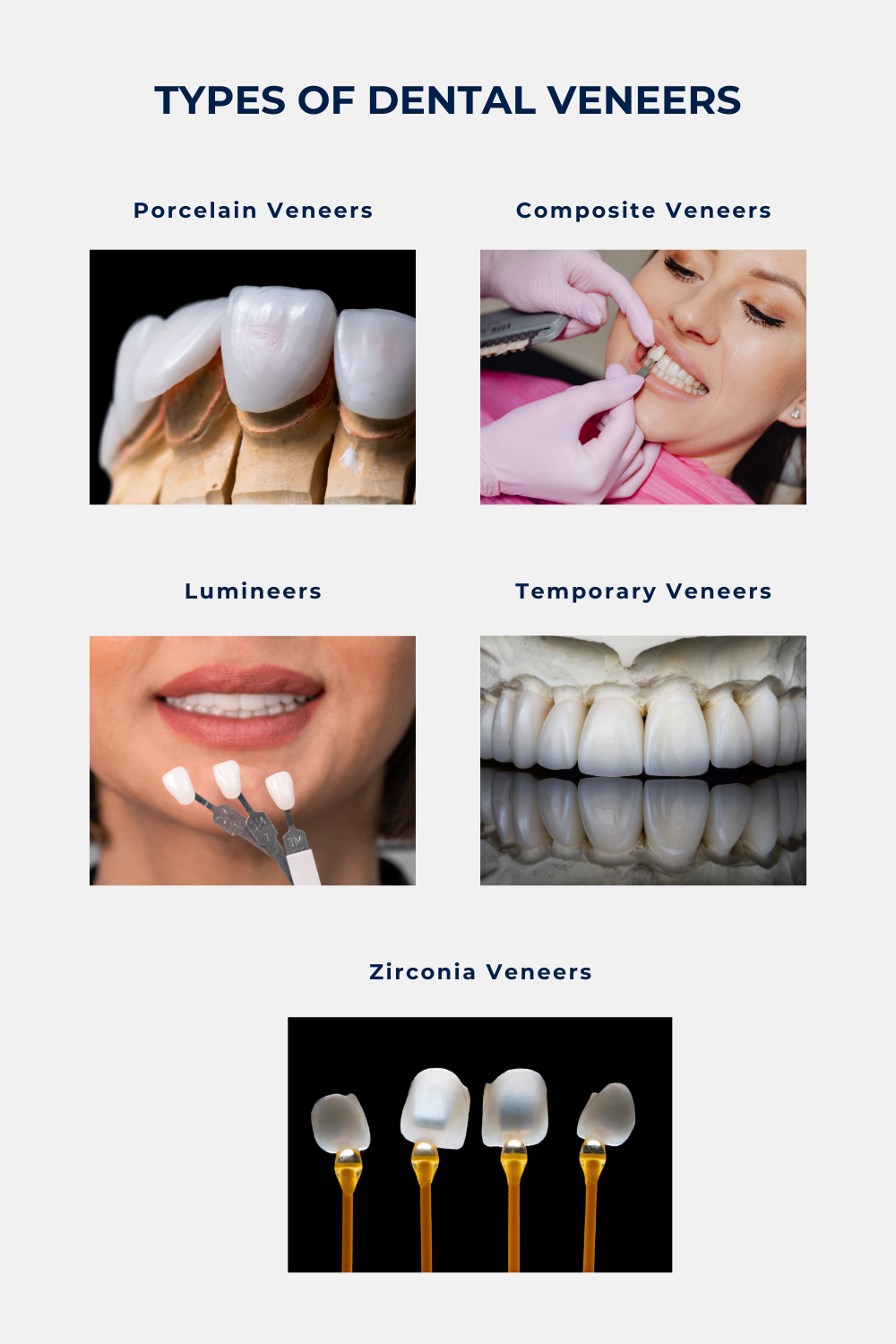 Types dental veneers