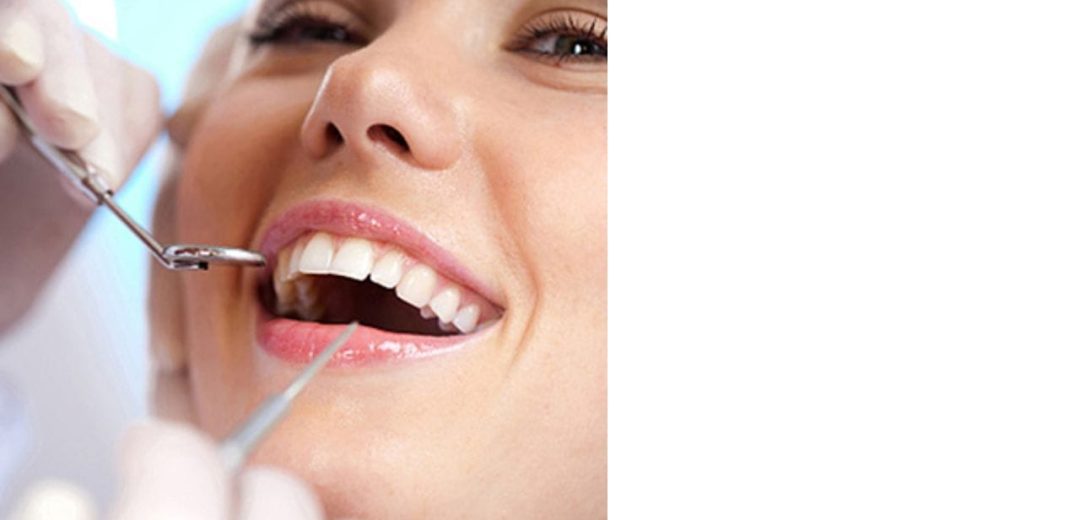 What are Dental Sealants