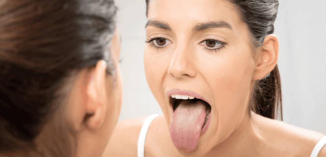 bumps on my tongue