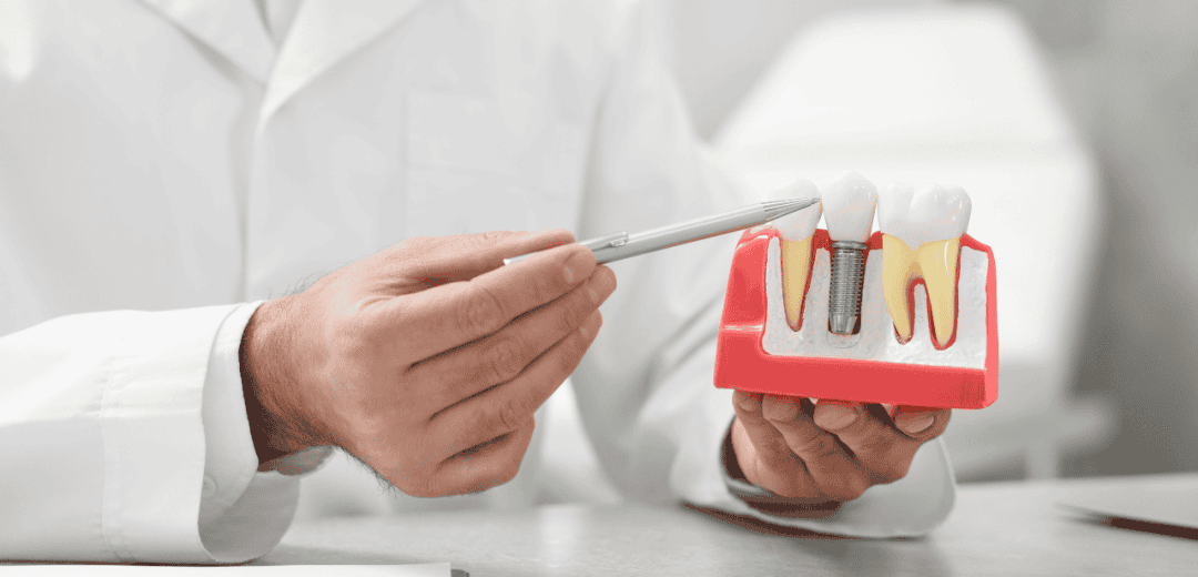 tooth in a day dental implants Types of Implants