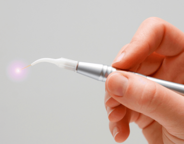 a hand holding a laser dental with white backgrounn