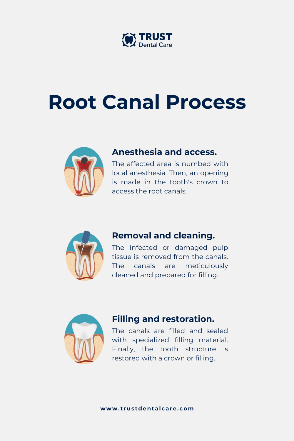 root canal dentist near me